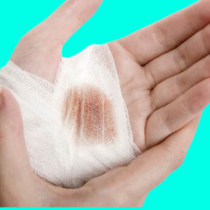 Mơ thấy bị thương và những ý nghĩa đằng sau